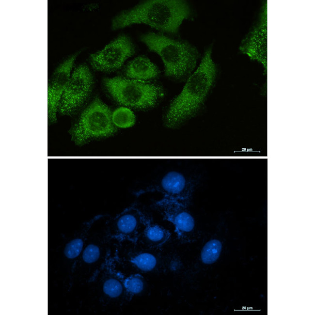 Moesin Antibody in Immunocytochemistry (ICC/IF)