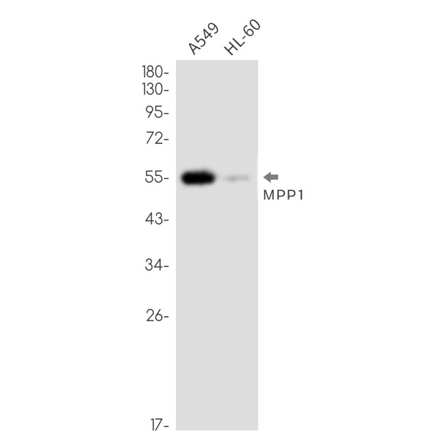 MPP1 Antibody in Western Blot (WB)