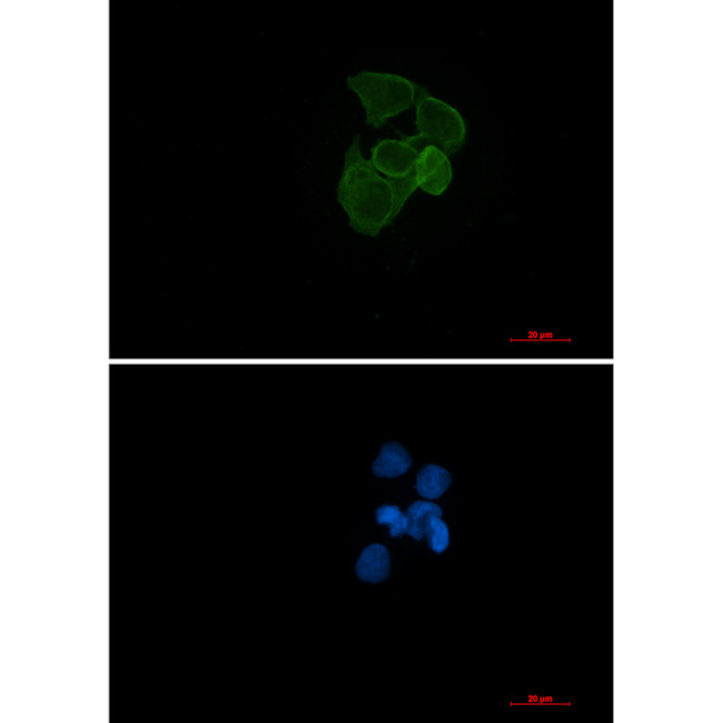 ACTA1 Antibody in Immunocytochemistry (ICC/IF)