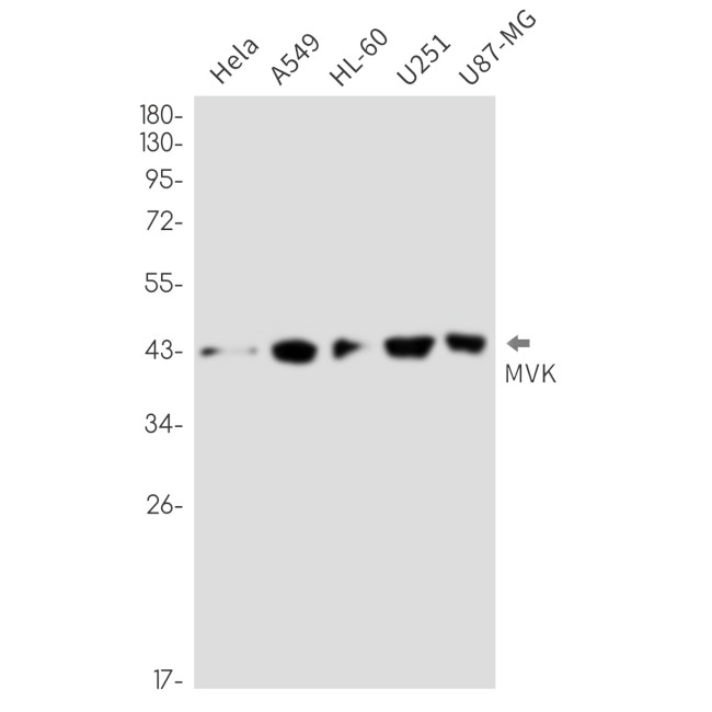 MVK Antibody in Western Blot (WB)