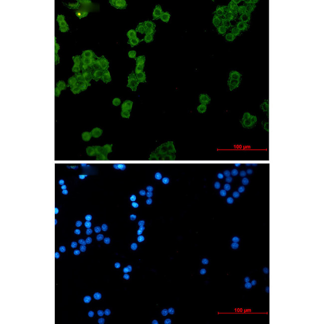 NDUFS1 Antibody in Immunocytochemistry (ICC/IF)