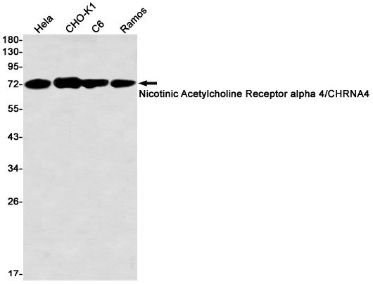 CHRNA4 Antibody in Western Blot (WB)