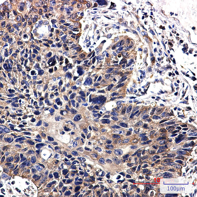 NME2 Antibody in Immunohistochemistry (Paraffin) (IHC (P))