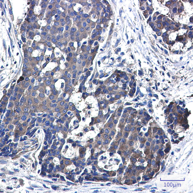 NME3 Antibody in Immunohistochemistry (Paraffin) (IHC (P))