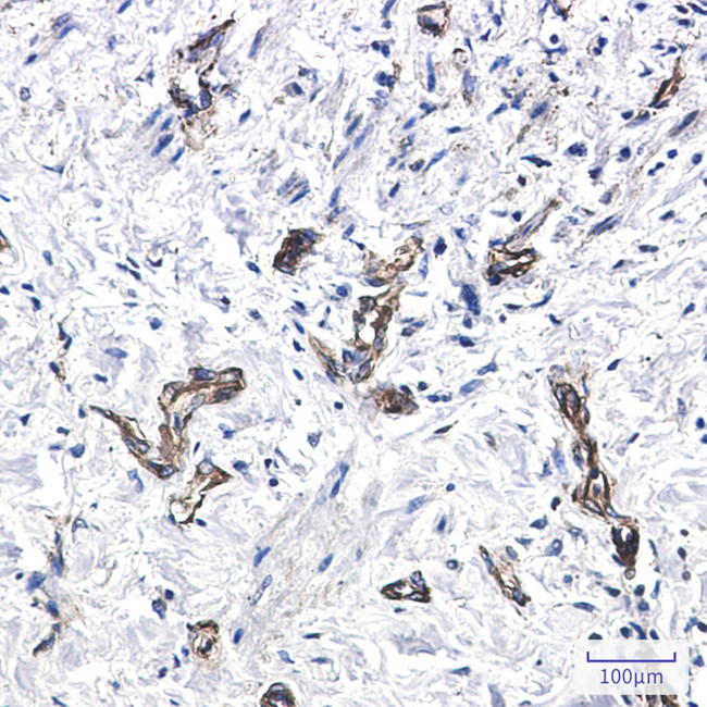 MYH9 Antibody in Immunohistochemistry (Paraffin) (IHC (P))