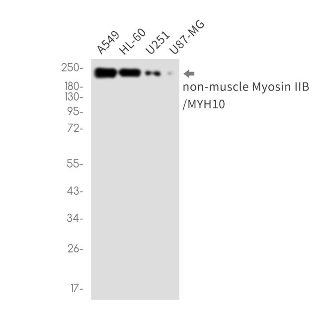 MYH10 Antibody in Western Blot (WB)