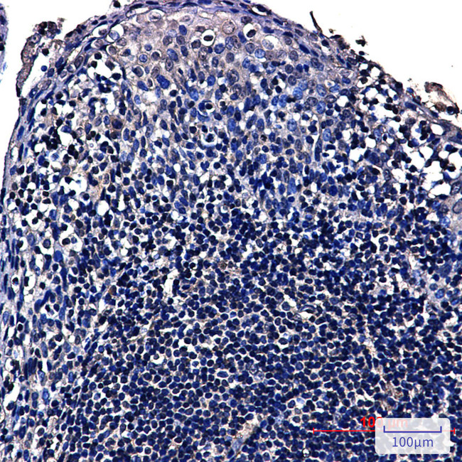 NOLA3 Antibody in Immunohistochemistry (Paraffin) (IHC (P))