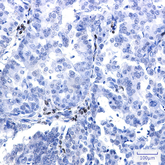 NR2F2 Antibody in Immunohistochemistry (Paraffin) (IHC (P))
