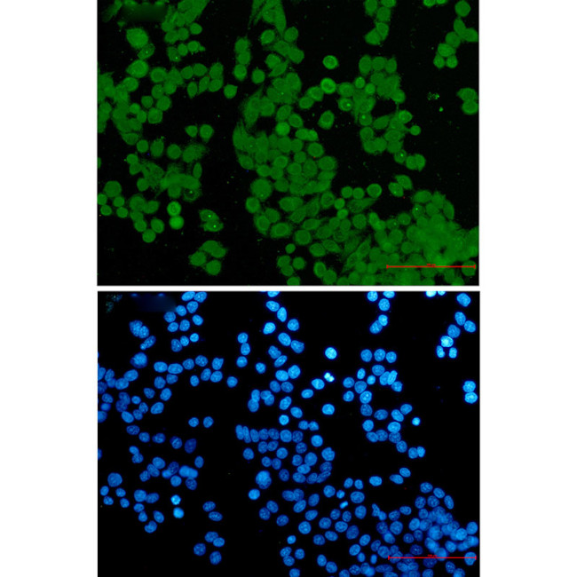 NUP50 Antibody in Immunocytochemistry (ICC/IF)