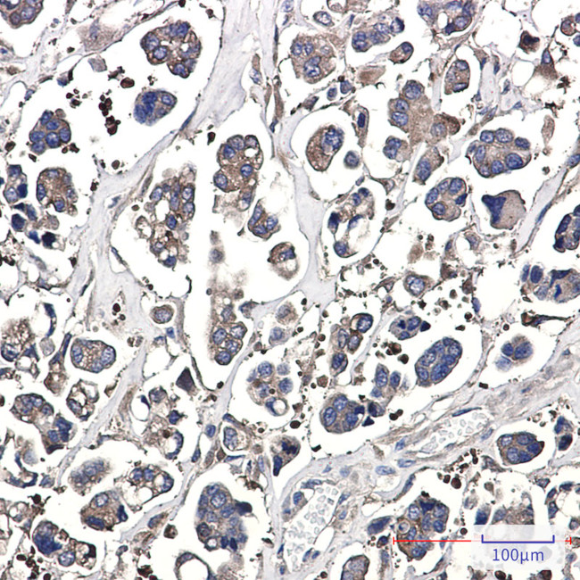 Optineurin Antibody in Immunohistochemistry (Paraffin) (IHC (P))