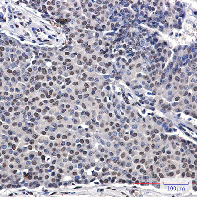 p57 Kip2 Antibody in Immunohistochemistry (Paraffin) (IHC (P))