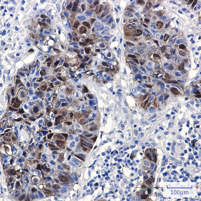 PBK Antibody in Immunohistochemistry (Paraffin) (IHC (P))