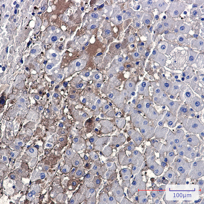 PF4 Antibody in Immunohistochemistry (Paraffin) (IHC (P))