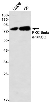 PKC theta Antibody in Western Blot (WB)