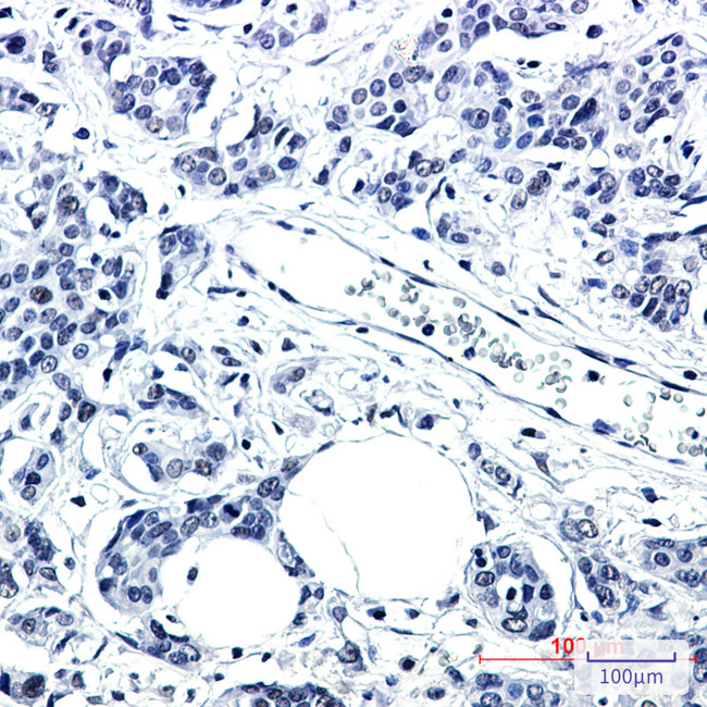 PNK Antibody in Immunohistochemistry (Paraffin) (IHC (P))