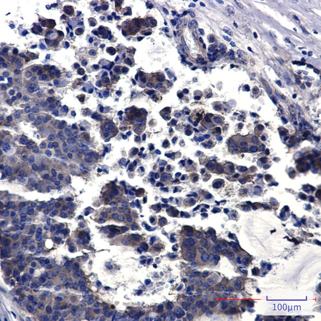 PREPL Antibody in Immunohistochemistry (Paraffin) (IHC (P))
