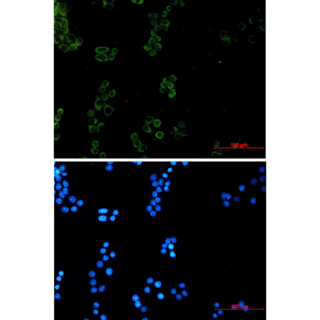 Prohibitin Antibody in Immunocytochemistry (ICC/IF)