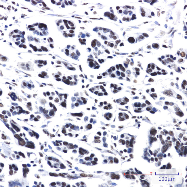 PRPF4 Antibody in Immunohistochemistry (Paraffin) (IHC (P))