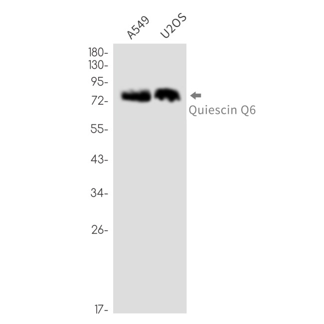 QSOX1 Antibody in Western Blot (WB)
