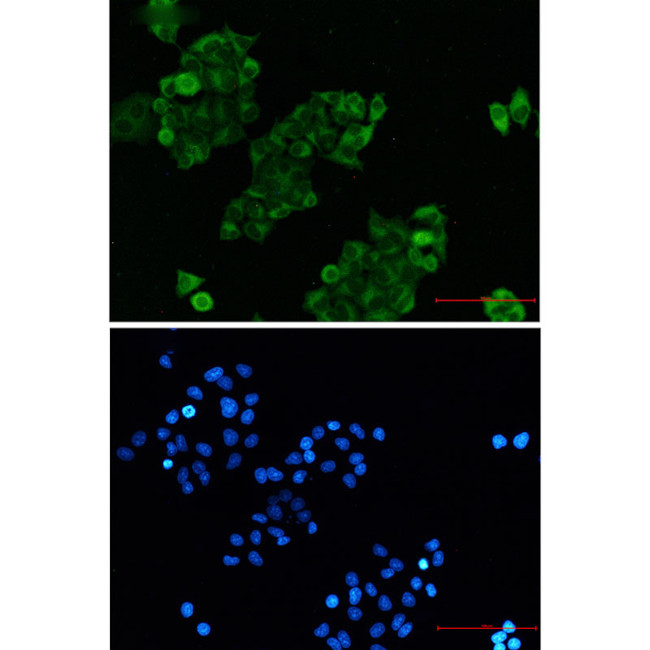 RAIDD Antibody in Immunocytochemistry (ICC/IF)