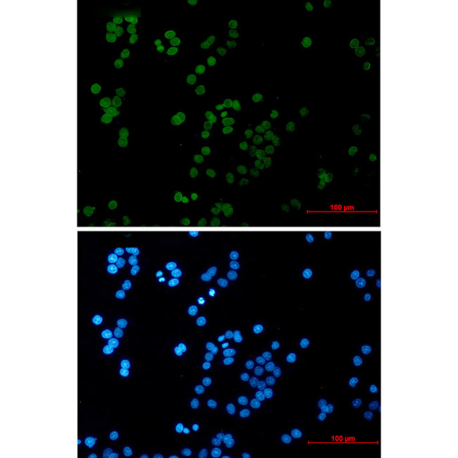 RAP80 Antibody in Immunocytochemistry (ICC/IF)