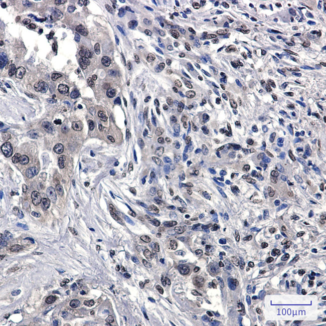 RASA1 Antibody in Immunohistochemistry (Paraffin) (IHC (P))