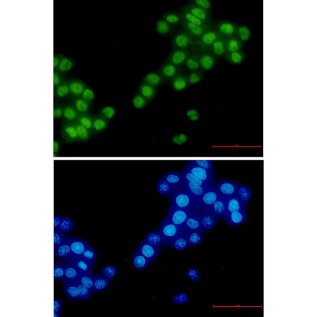RBM3 Antibody in Immunocytochemistry (ICC/IF)