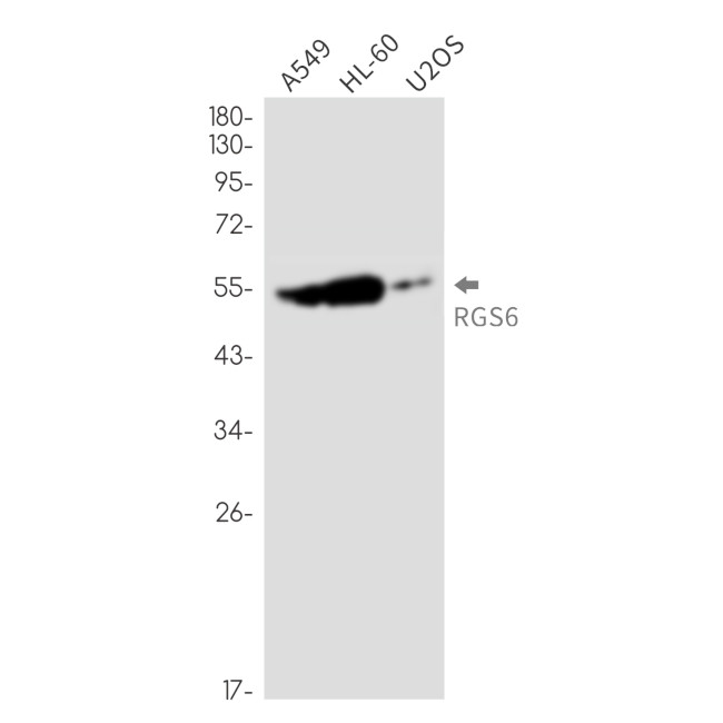RGS6 Antibody in Western Blot (WB)