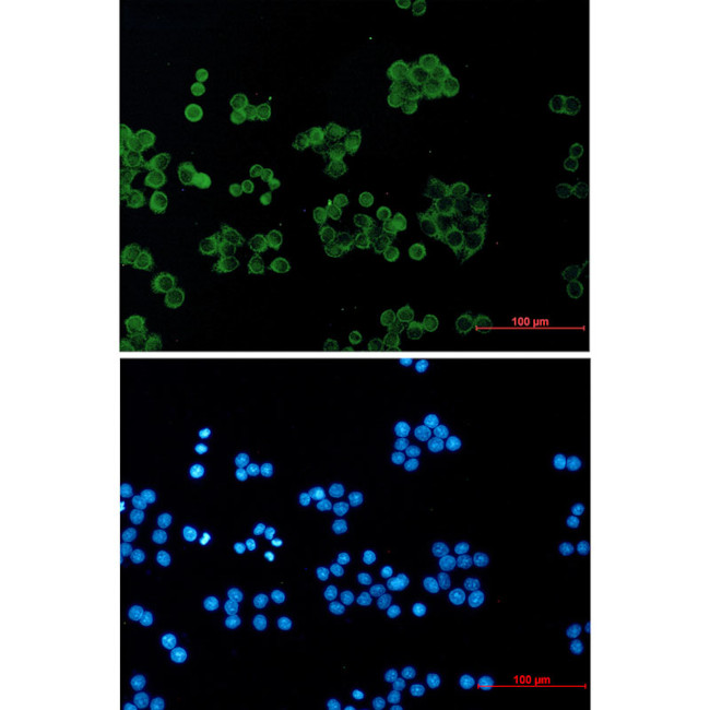 RhoGDI Antibody in Immunocytochemistry (ICC/IF)