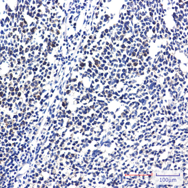 RPS20 Antibody in Immunohistochemistry (Paraffin) (IHC (P))