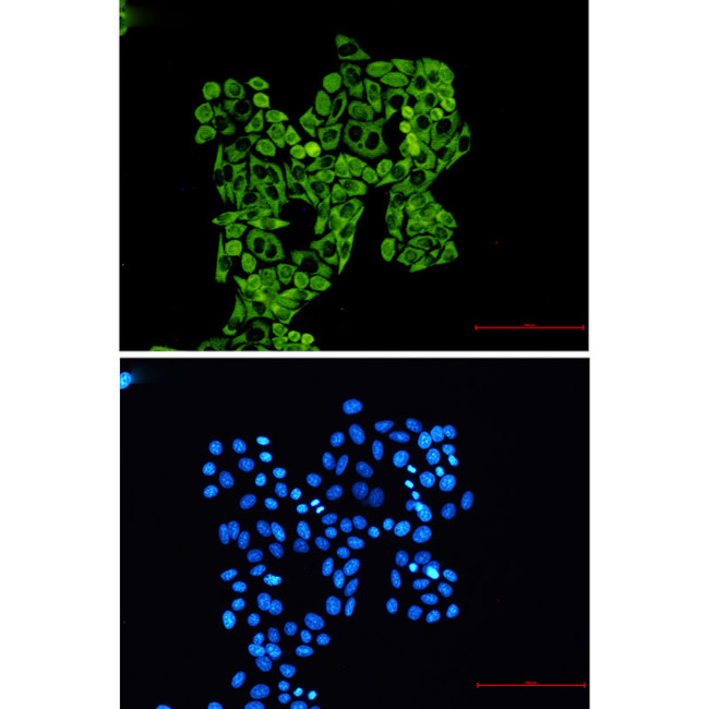 RPS8 Antibody in Immunocytochemistry (ICC/IF)
