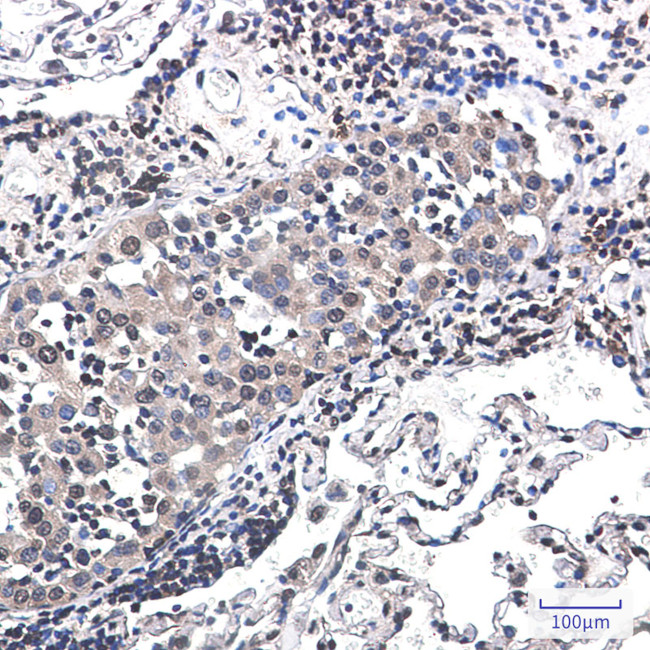 RSK2 Antibody in Immunohistochemistry (Paraffin) (IHC (P))