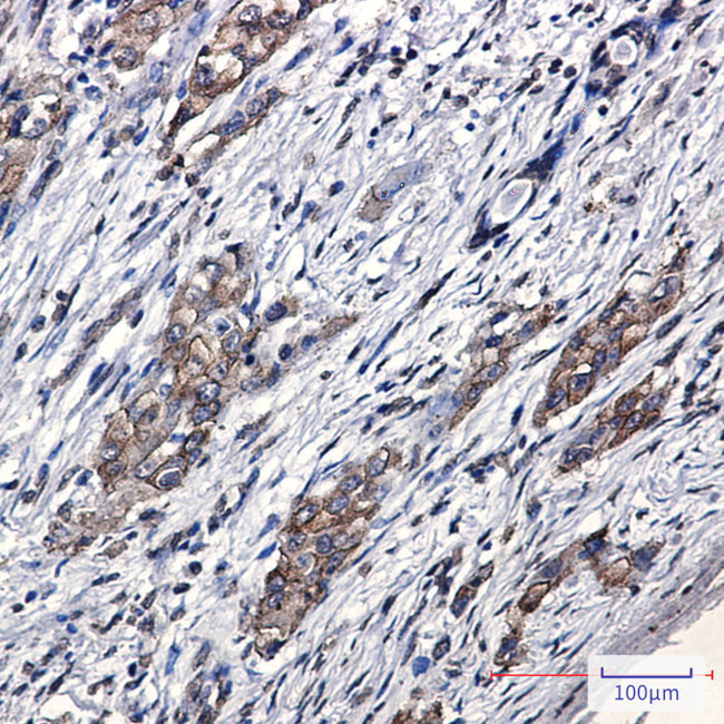 ZFYVE9 Antibody in Immunohistochemistry (Paraffin) (IHC (P))