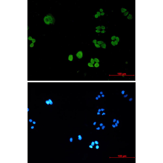 SBDS Antibody in Immunocytochemistry (ICC/IF)
