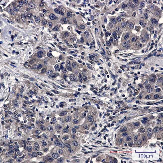 UBE2D1 Antibody in Immunohistochemistry (Paraffin) (IHC (P))