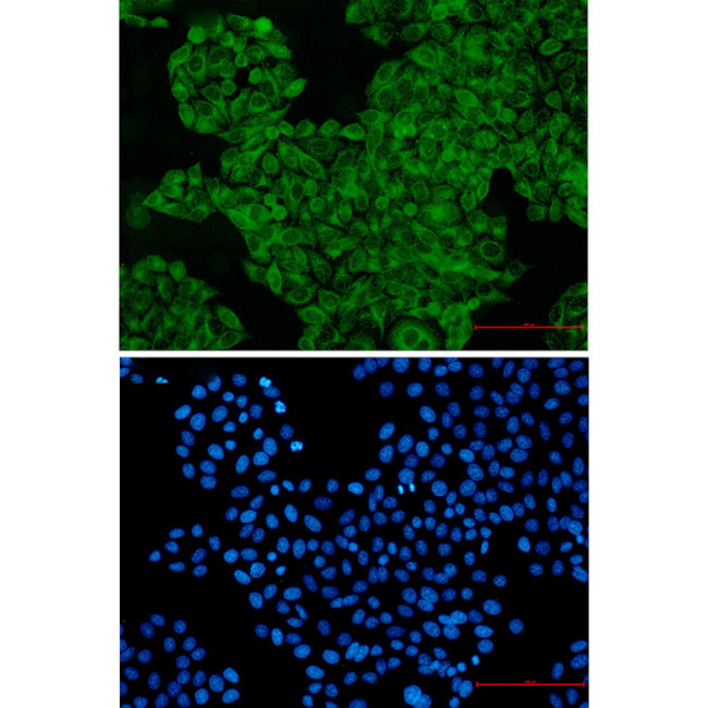 SNX1 Antibody in Immunocytochemistry (ICC/IF)
