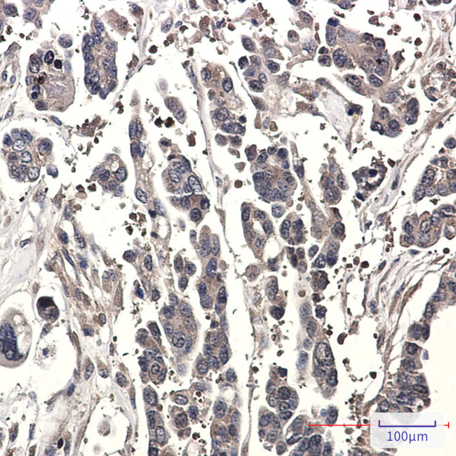 STK39 Antibody in Immunohistochemistry (Paraffin) (IHC (P))
