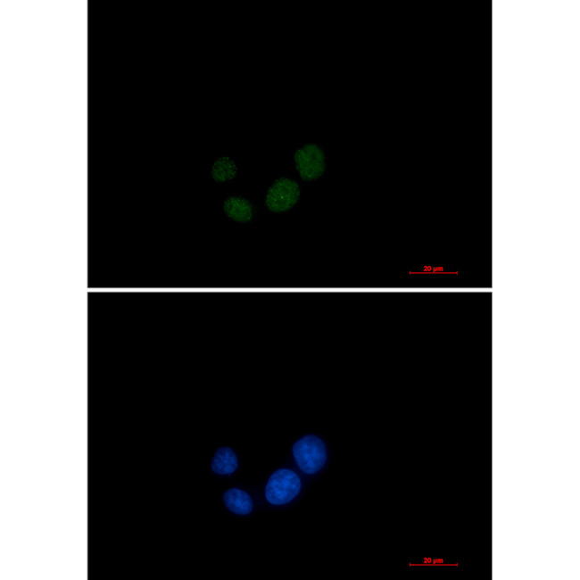 SPT5 Antibody in Immunocytochemistry (ICC/IF)