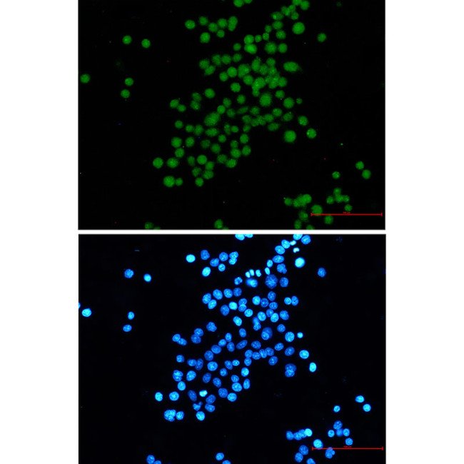 SV40 T-Antigen Antibody in Immunocytochemistry (ICC/IF)