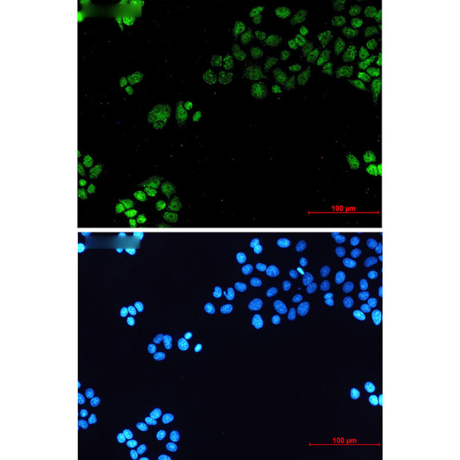 TBP Antibody in Immunocytochemistry (ICC/IF)