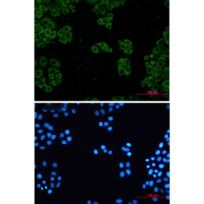 TCP1 Antibody in Immunocytochemistry (ICC/IF)