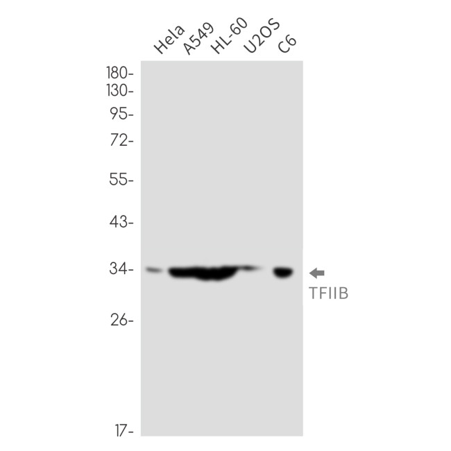 GTF2B Antibody in Western Blot (WB)