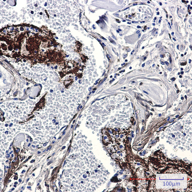 Thrombospondin 1 Antibody in Immunohistochemistry (Paraffin) (IHC (P))