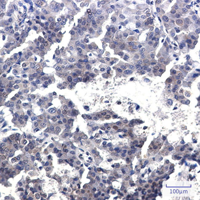 Torc2 Antibody in Immunohistochemistry (Paraffin) (IHC (P))