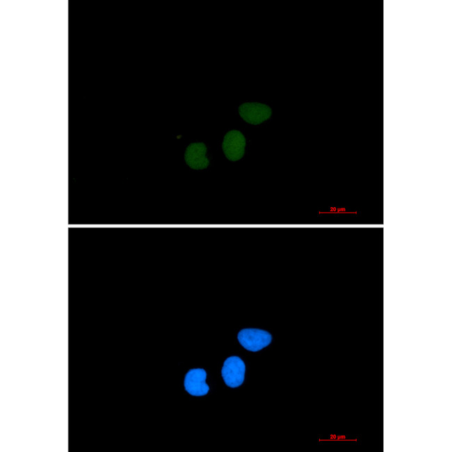 TPX2 Antibody in Immunocytochemistry (ICC/IF)