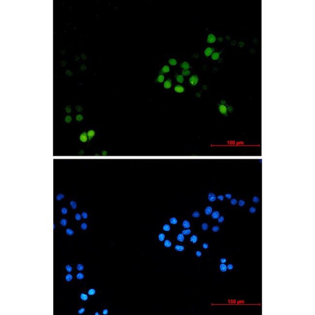 TPX2 Antibody in Immunocytochemistry (ICC/IF)
