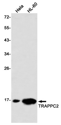 TRAPPC2 Antibody in Western Blot (WB)