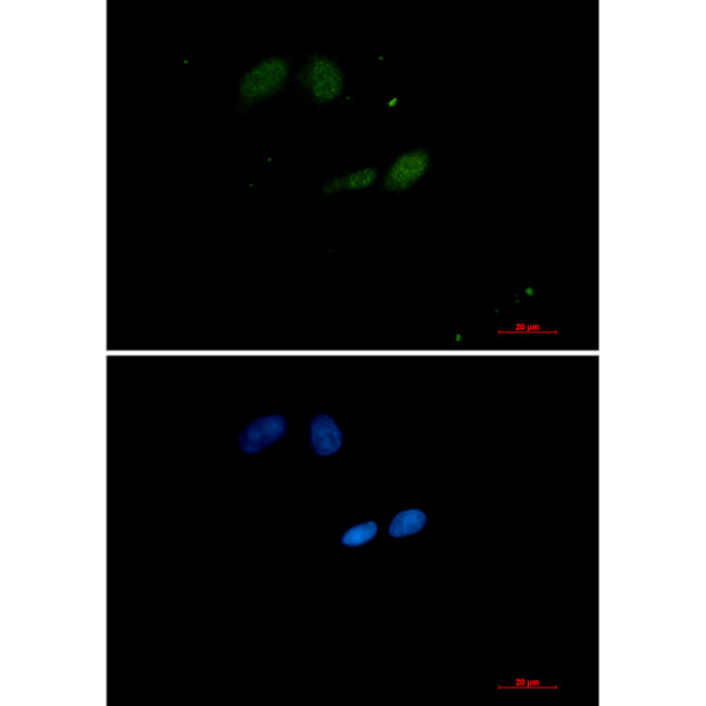 UBC9 Antibody in Immunocytochemistry (ICC/IF)
