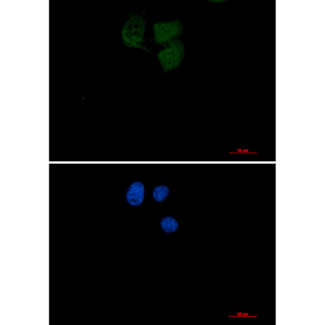 UBC13 Antibody in Immunocytochemistry (ICC/IF)