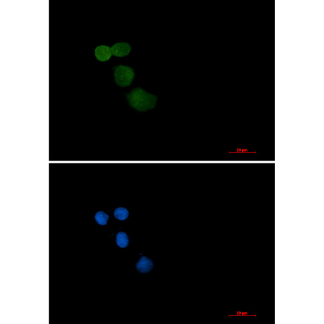 E6AP Antibody in Immunocytochemistry (ICC/IF)